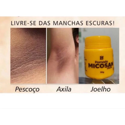 Pomada Micosan Original Baruc Cosméticos - micosan - pomada micosan -  clareamento - clarear virilha - clareia manchas